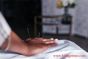 Acupuncture in Orillia
